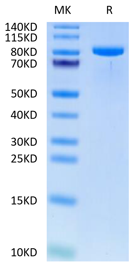 Human TIE1 Protein (TIE-HM101)