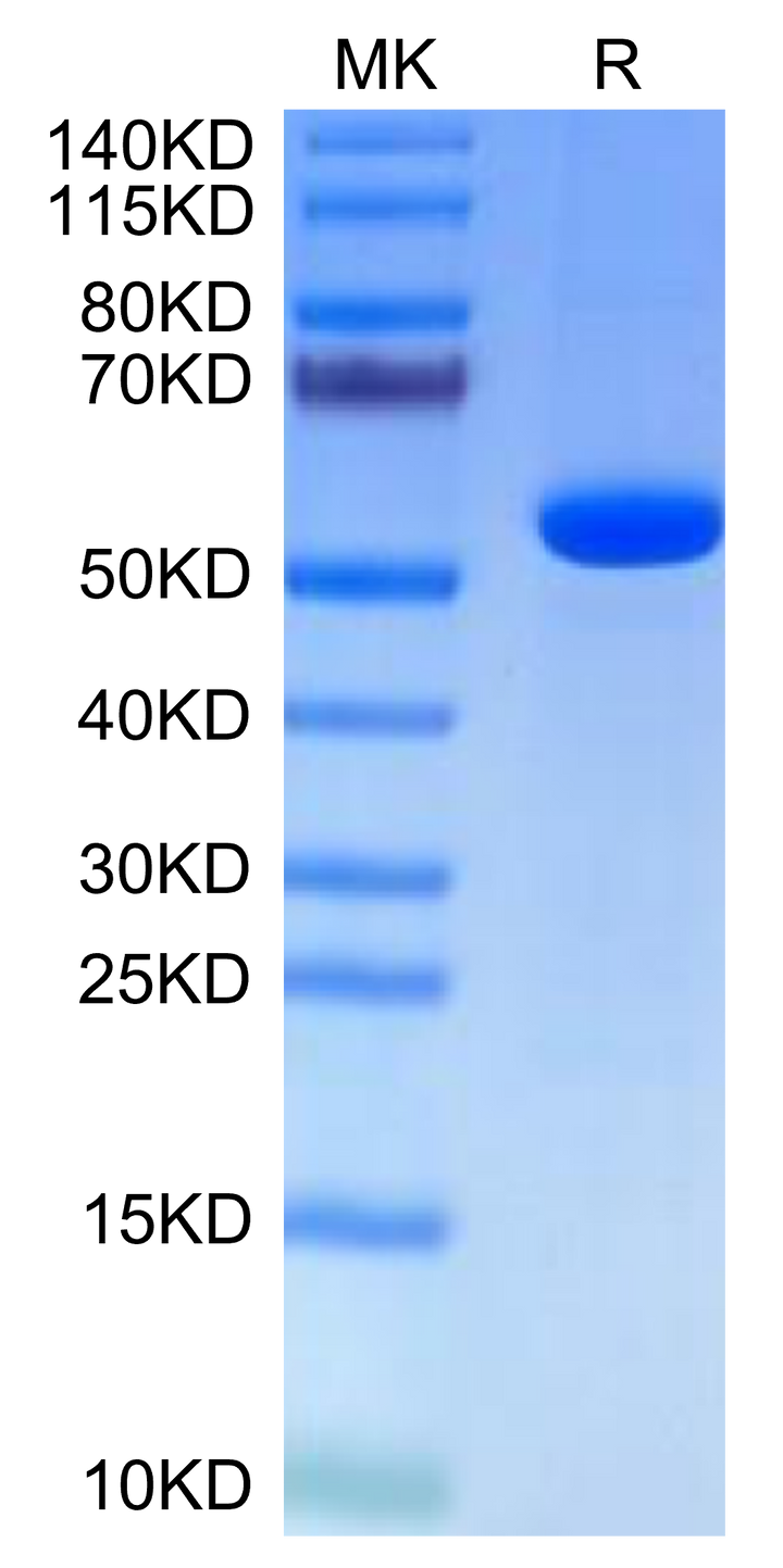 Human Hyaluronidase 2/HYAL2-Protein (HYA-HM101)