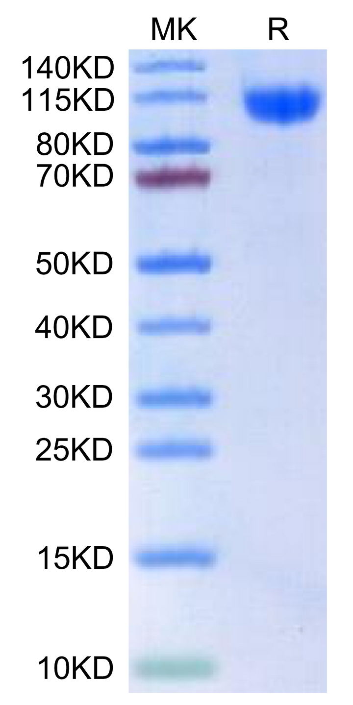 Human RET-Protein (RET-HM101)