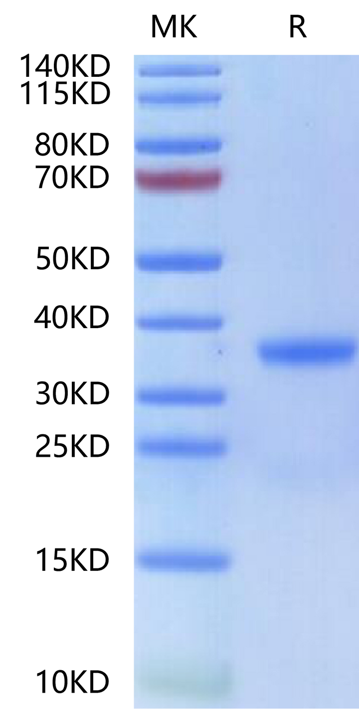 Human Kallikrein 3/KLK3-Protein (KLK-HM103)