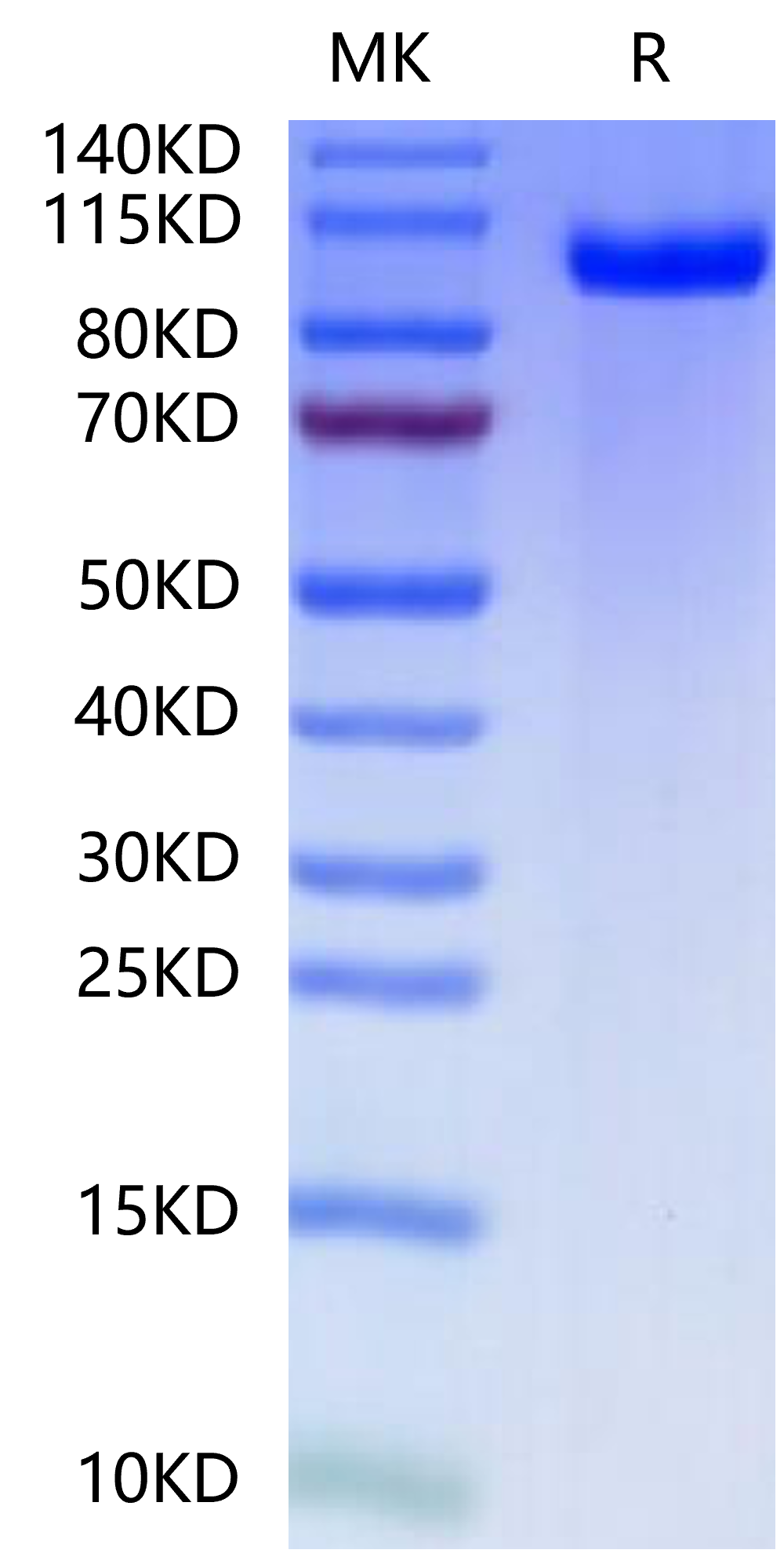 Mouse PTK7/CCK4 Protein (CCK-MM104)