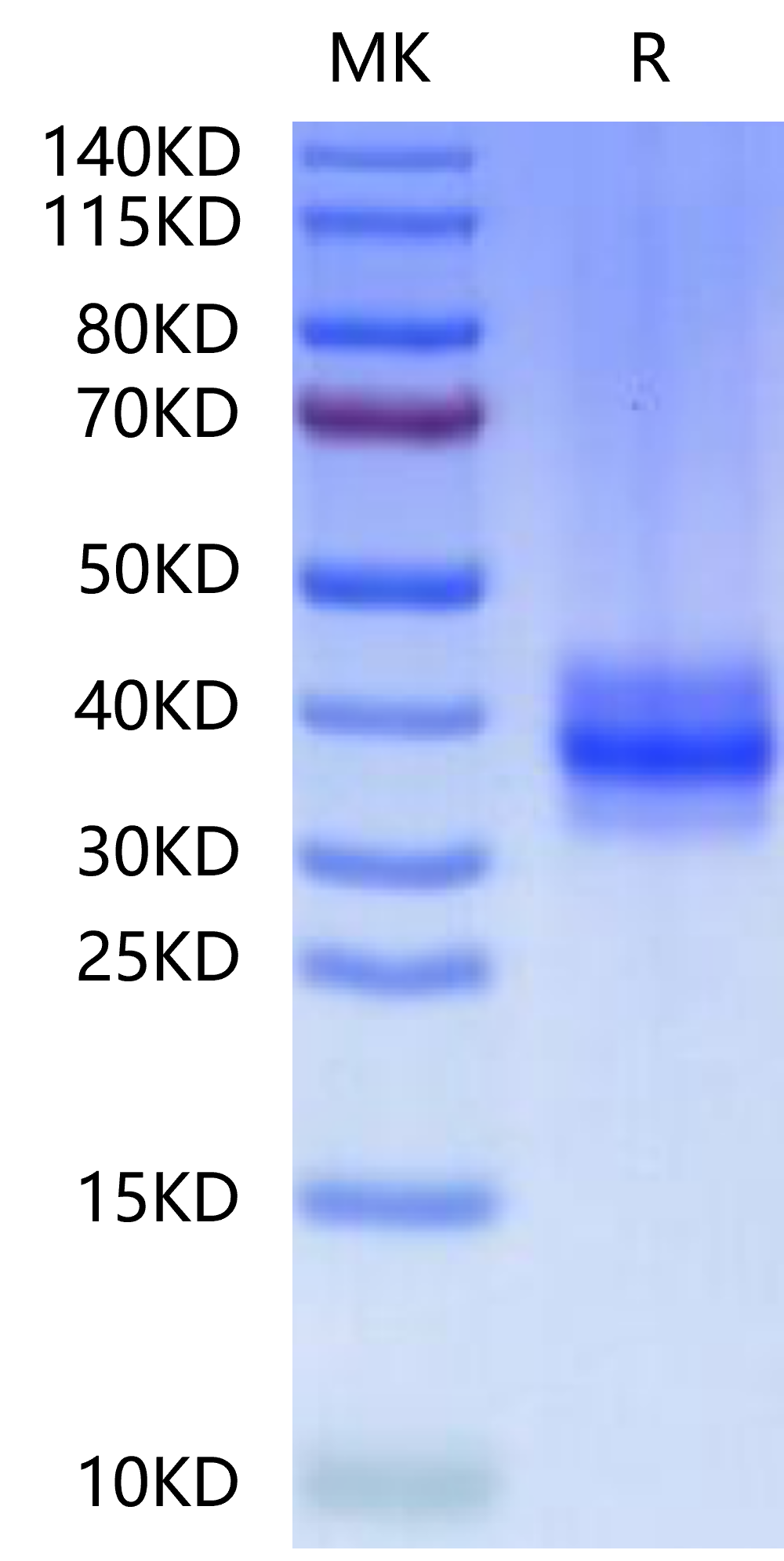 Human FOLR3-Protein (FOL-HM1R3)