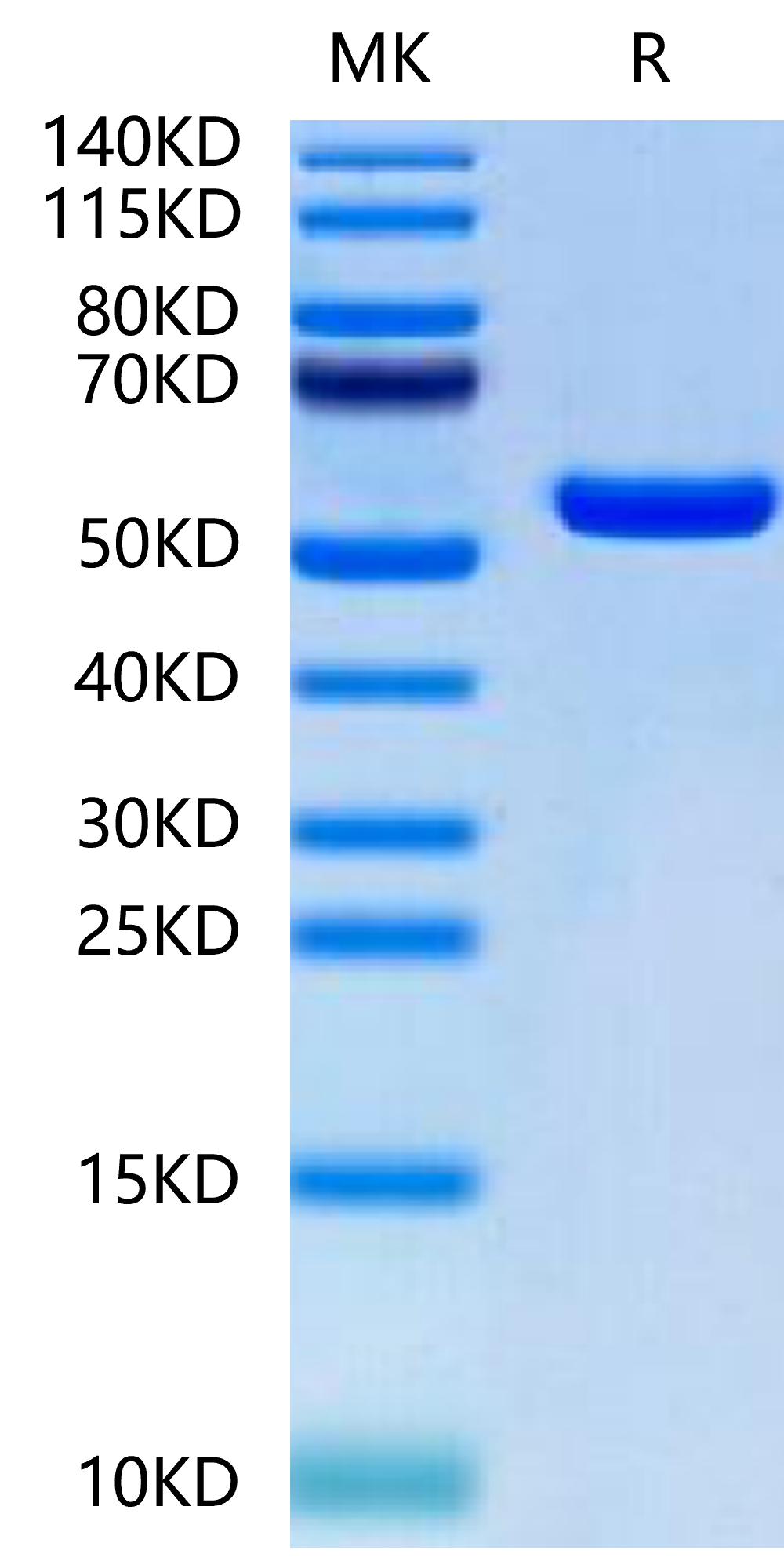 Biotinylated Human HLA-A*02:01&B2M&MAGE-A1 (KVLEYVIKV) Monomer Protein (MHC-HM445B)