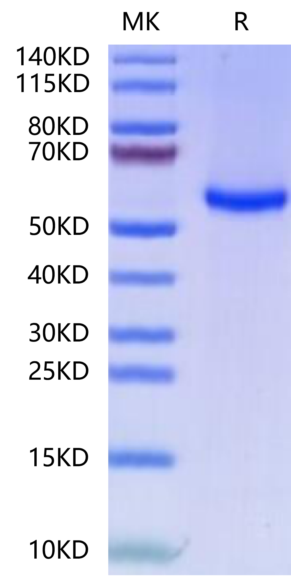 FITC-Labeled Human HLA-A*11:01&B2M&KRAS G12V (VVVGAVGVGK) Monomer Protein (MHC-HM421F)