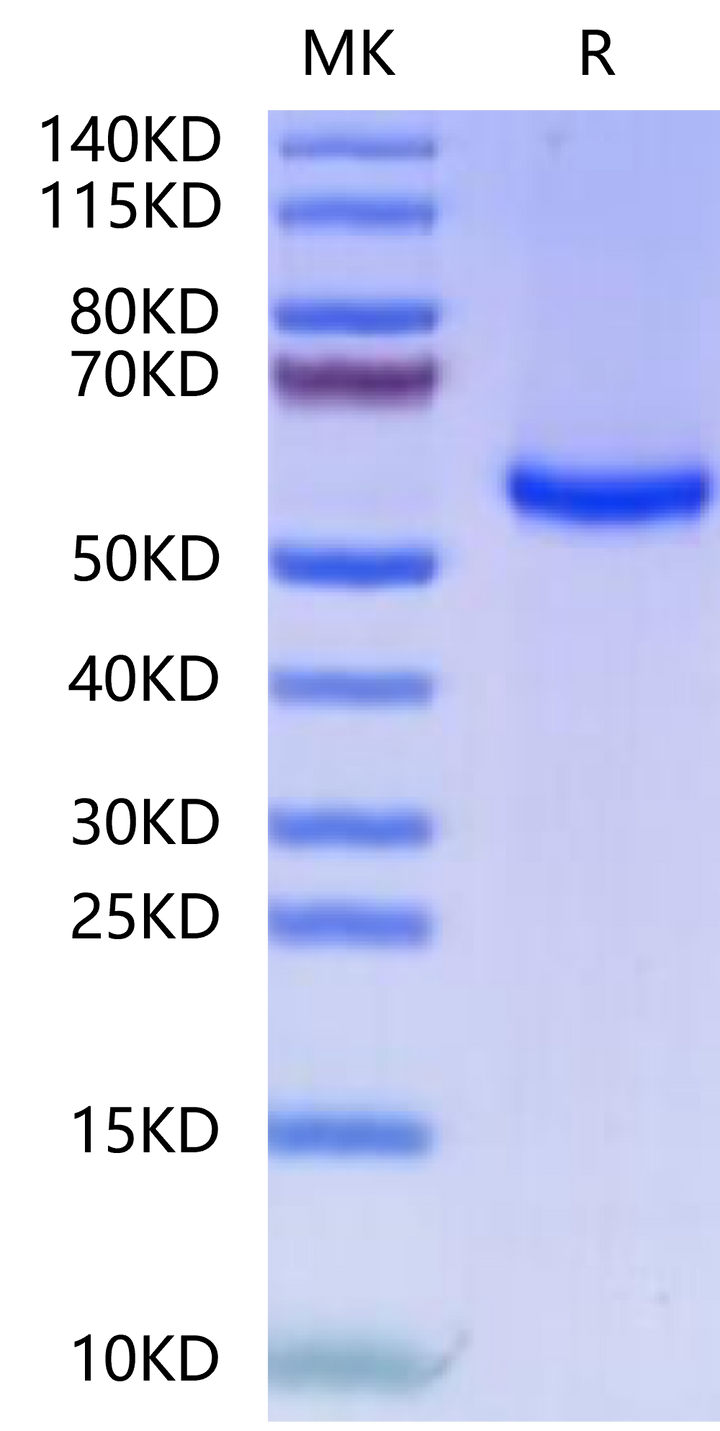 FITC-Labeled Human HLA-A*11:01&B2M&KRAS G12V (VVVGAVGVGK) Monomer Protein (MHC-HM421F)