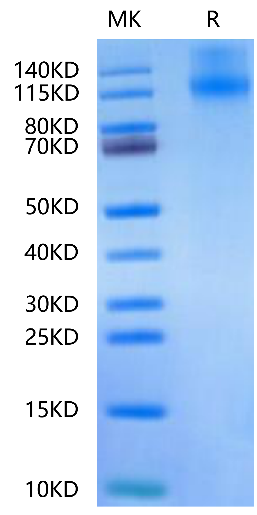 Canine OSMR-Protein (OSM-DM101)