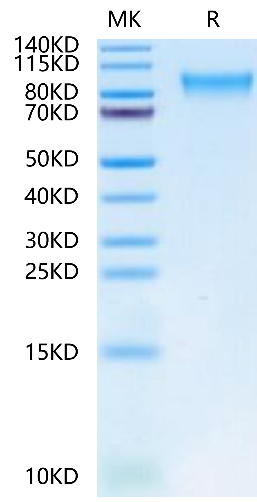 Canine ICAM-1/CD54 Protein, Ultra Low Endotoxin (ICM-DM101-UL)