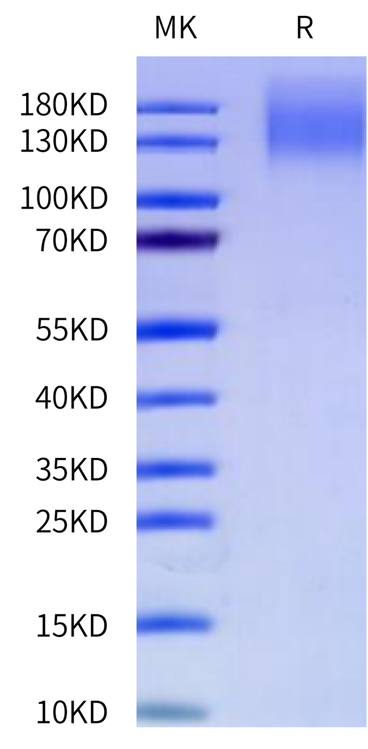 Cynomolgus CEACAM-5/CD66e Protein, Ultra Low Endotoxin (CAM-CM105-UL)