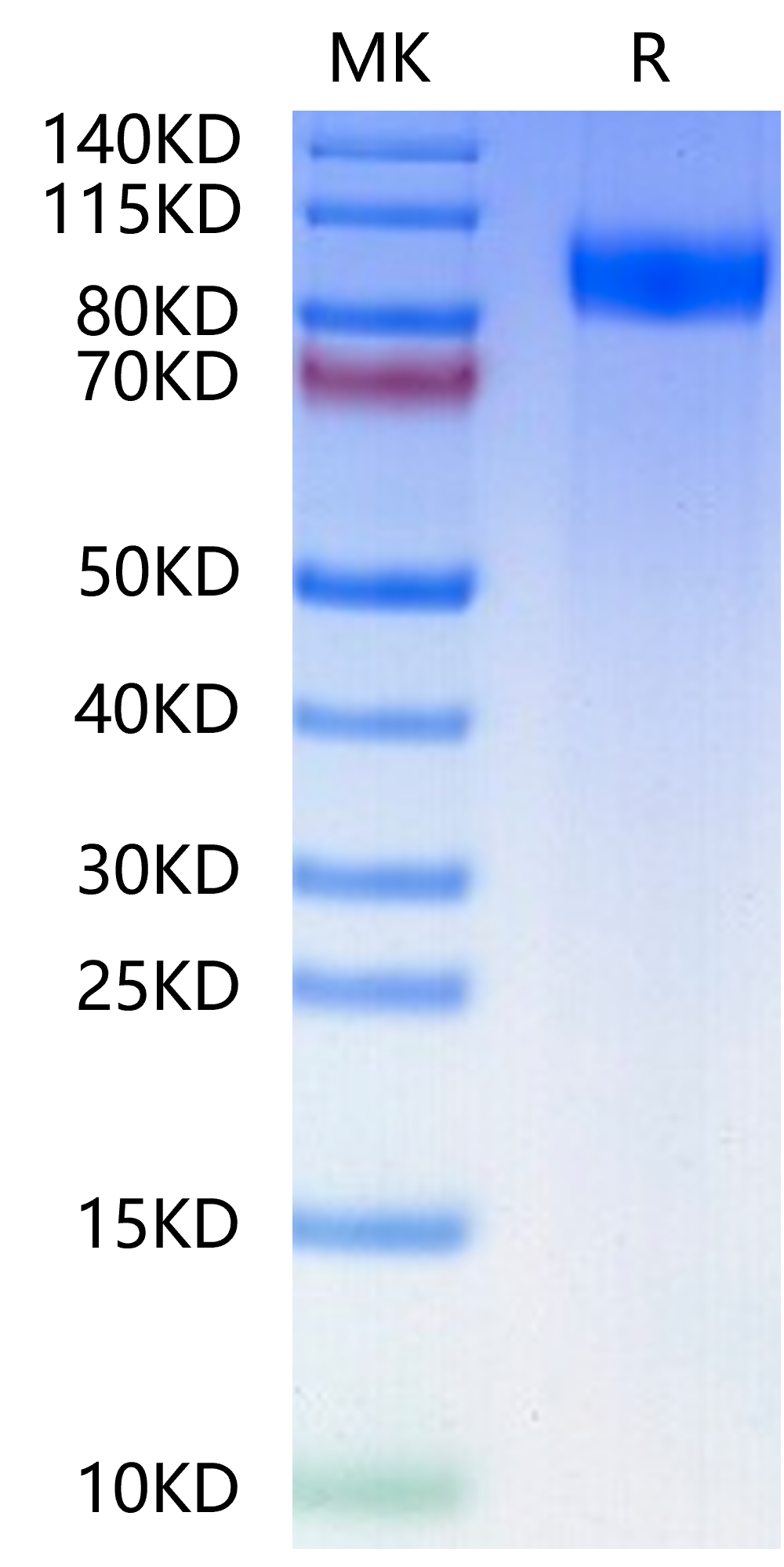 Human gp130/CD130/IL-6 R beta-Protein (GP1-HM130)