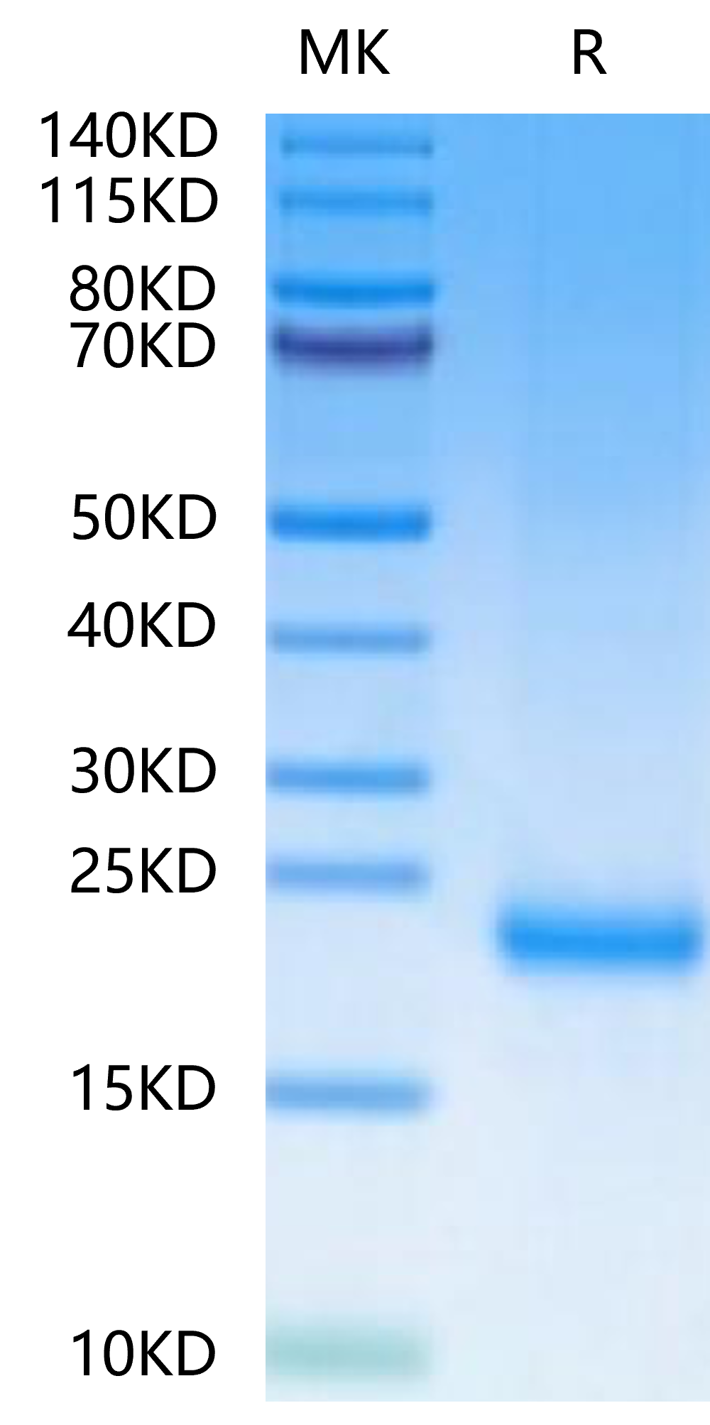 Mouse MOG/Myelin Oligodendrocyte Glycoprotein Protein, Ultra Low Endotoxin (MOG-MM101-UL)