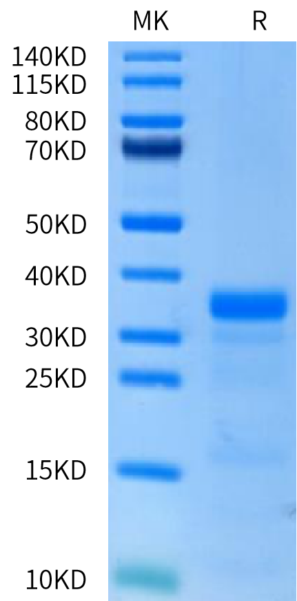 Human PLAU/uPA Protein (active form) (PLA-HM101)