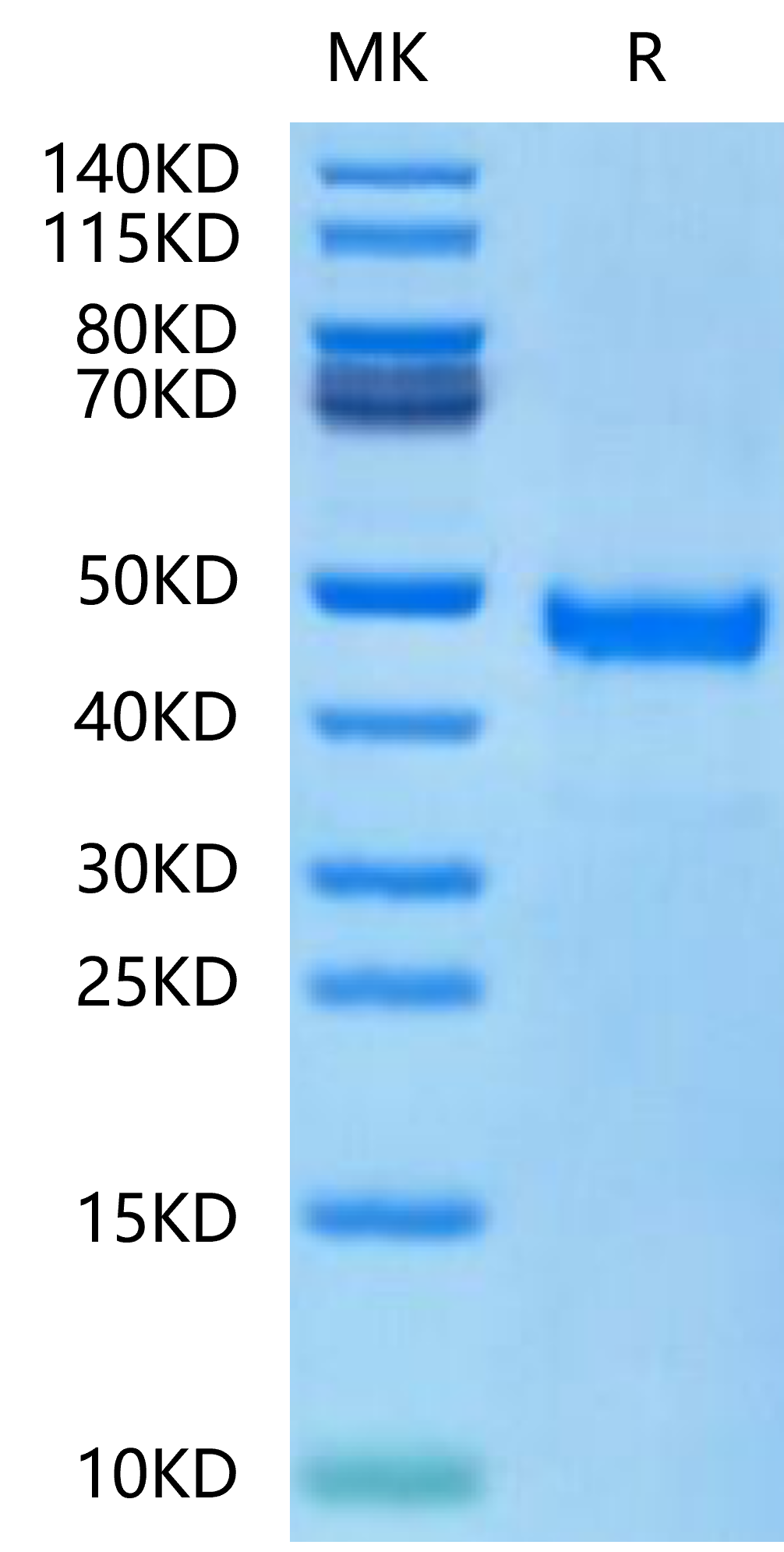 Human DKK1 N terminal Domain Protein (DKK-HM31N)