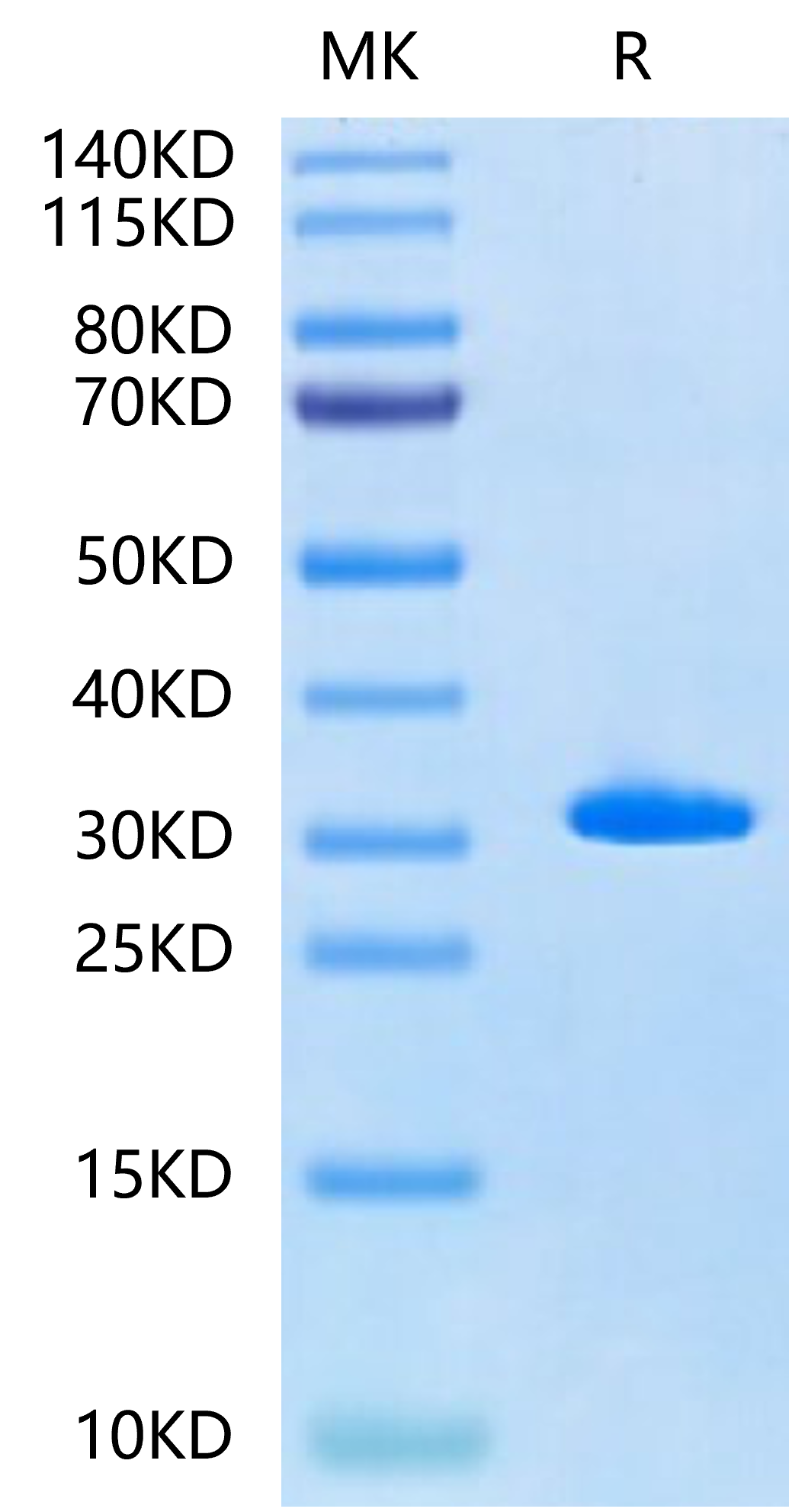 Human Latexin-Protein (LAT-HE101)