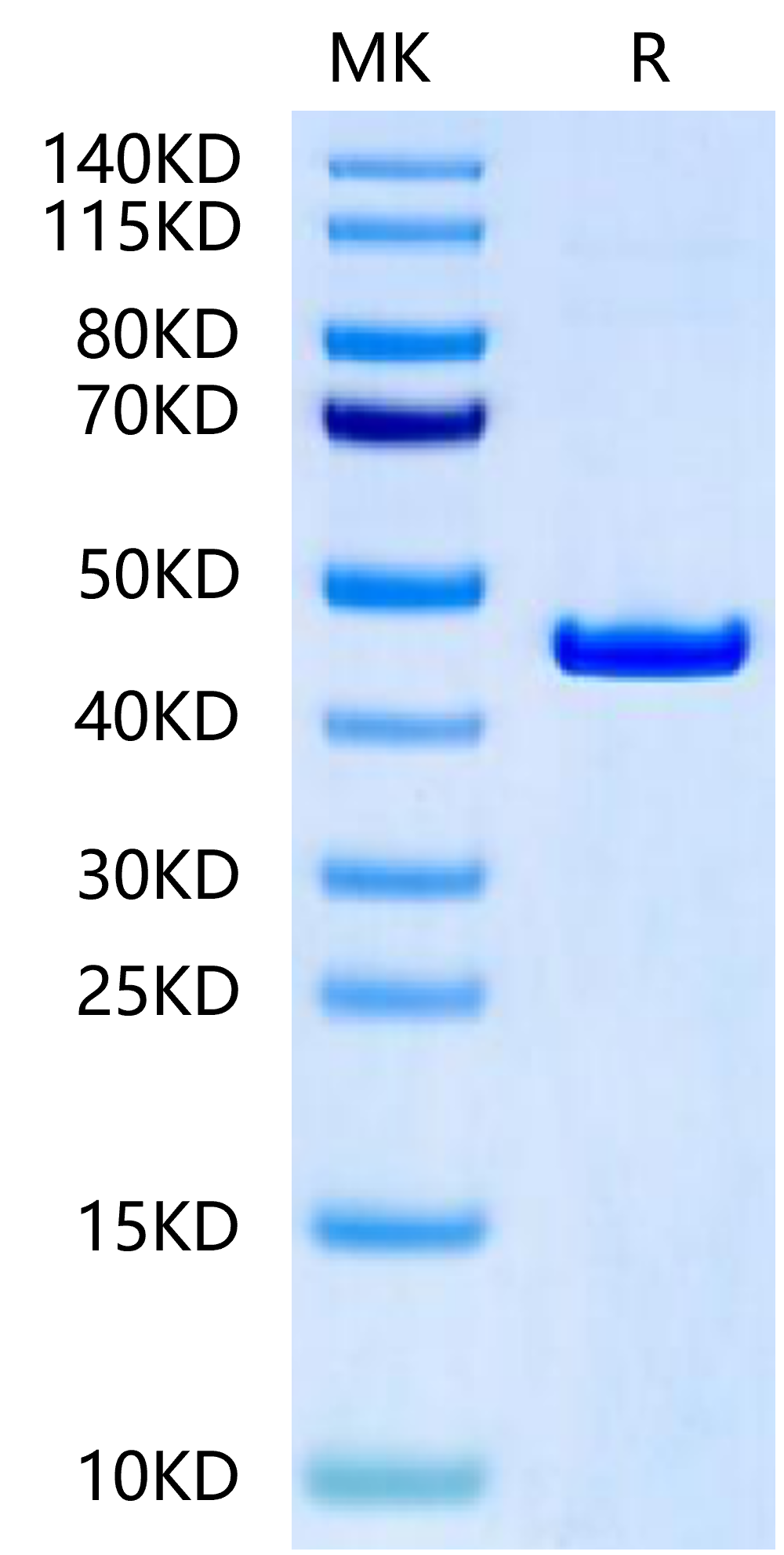 Rat CKMT2-Protein (CKM-RE002)