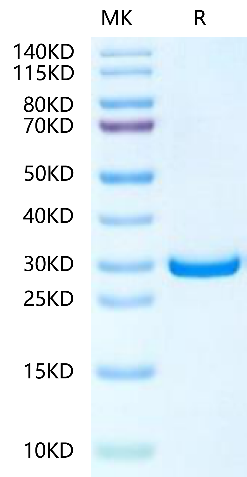 Human PHOSPHO1-Protein, Ultra Low Endotoxin (PHO-HE101-UL)