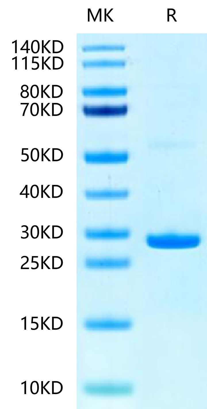 Human Hsp27/HSPB1-Protein (HSP-HE001)