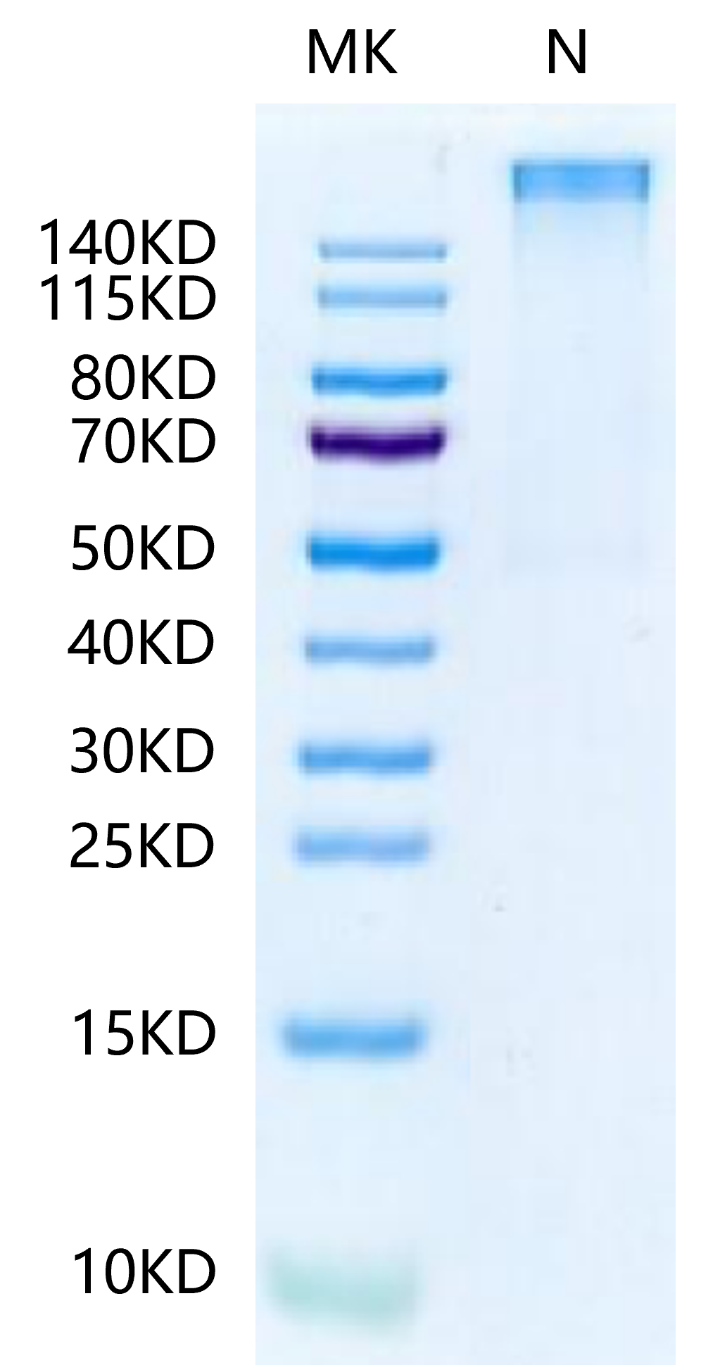 Human HLA-A*11:01&B2M&KRAS G12R (VVVGARGVGK) Tetramer Protein (MHC-HM440T)