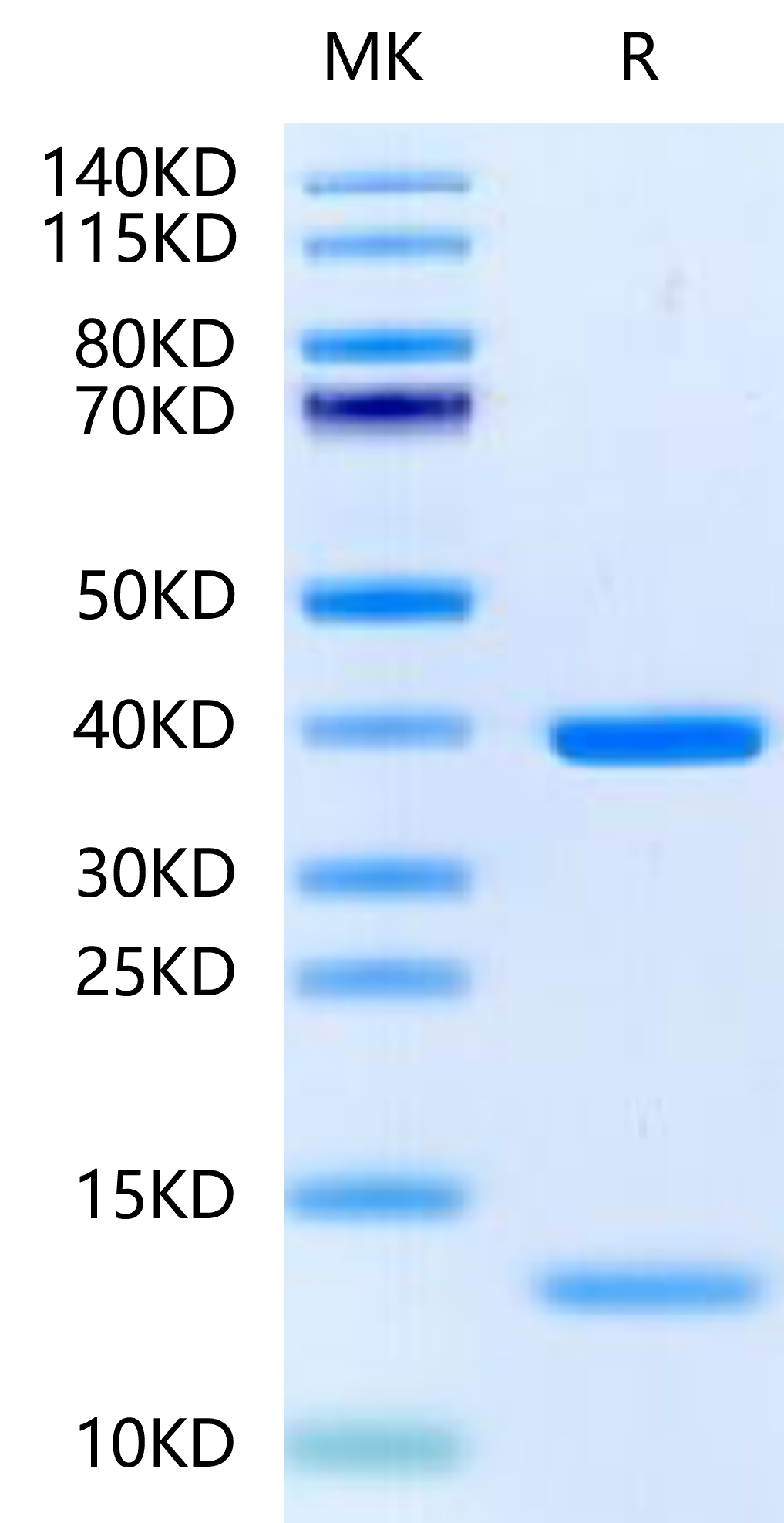 Biotinylated Human HLA-A*11:01&B2M&KRAS G12D (VVGADGVGK) Monomer Protein (MHC-HM455B)