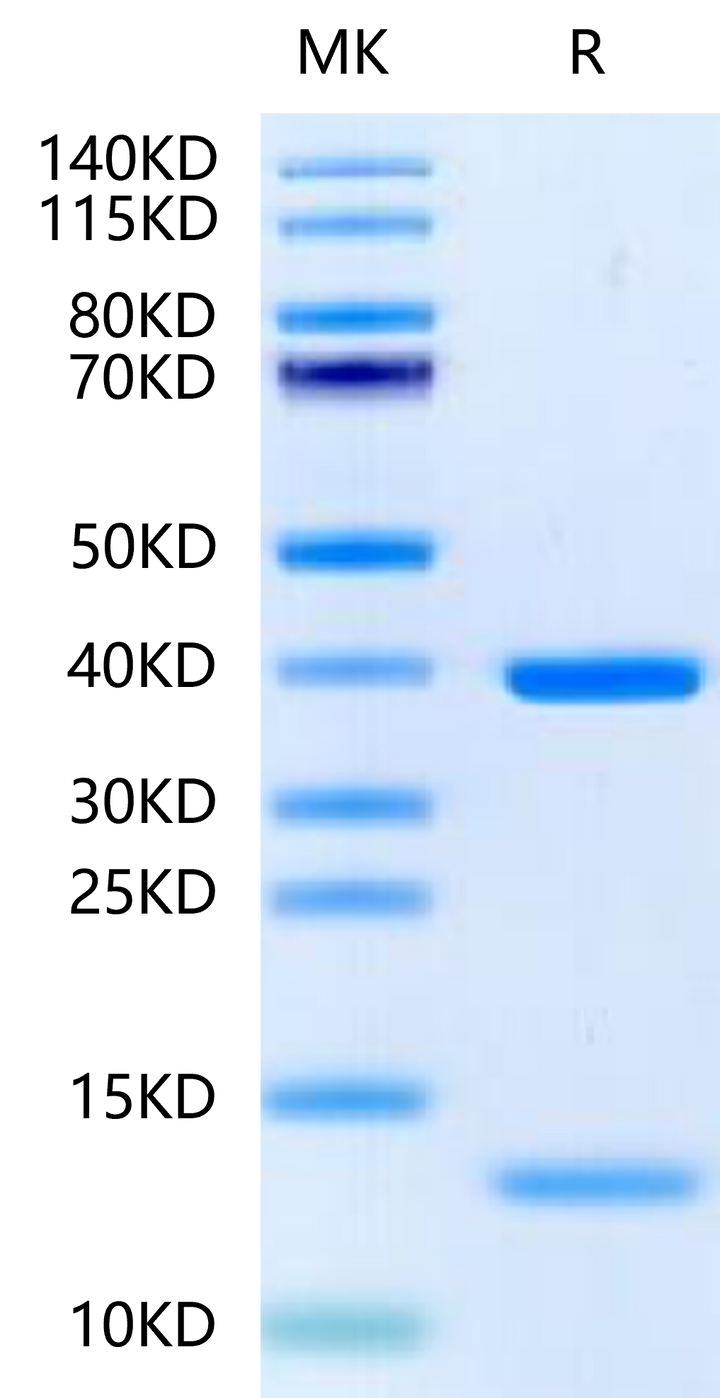 Biotinylated Human HLA-A*11:01&B2M&KRAS G12D (VVGADGVGK) Monomer Protein (MHC-HM455B)