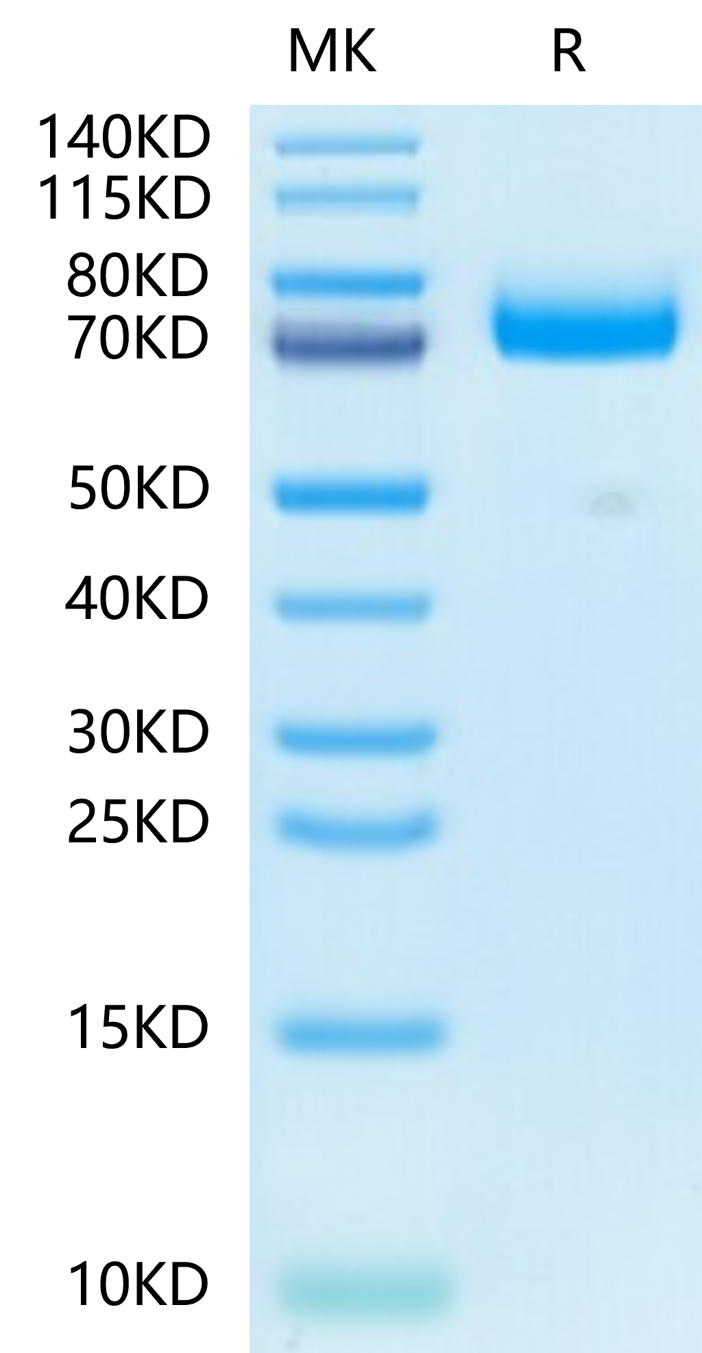 Mouse CD36/SR-B3 Protein (CD3-MM136)