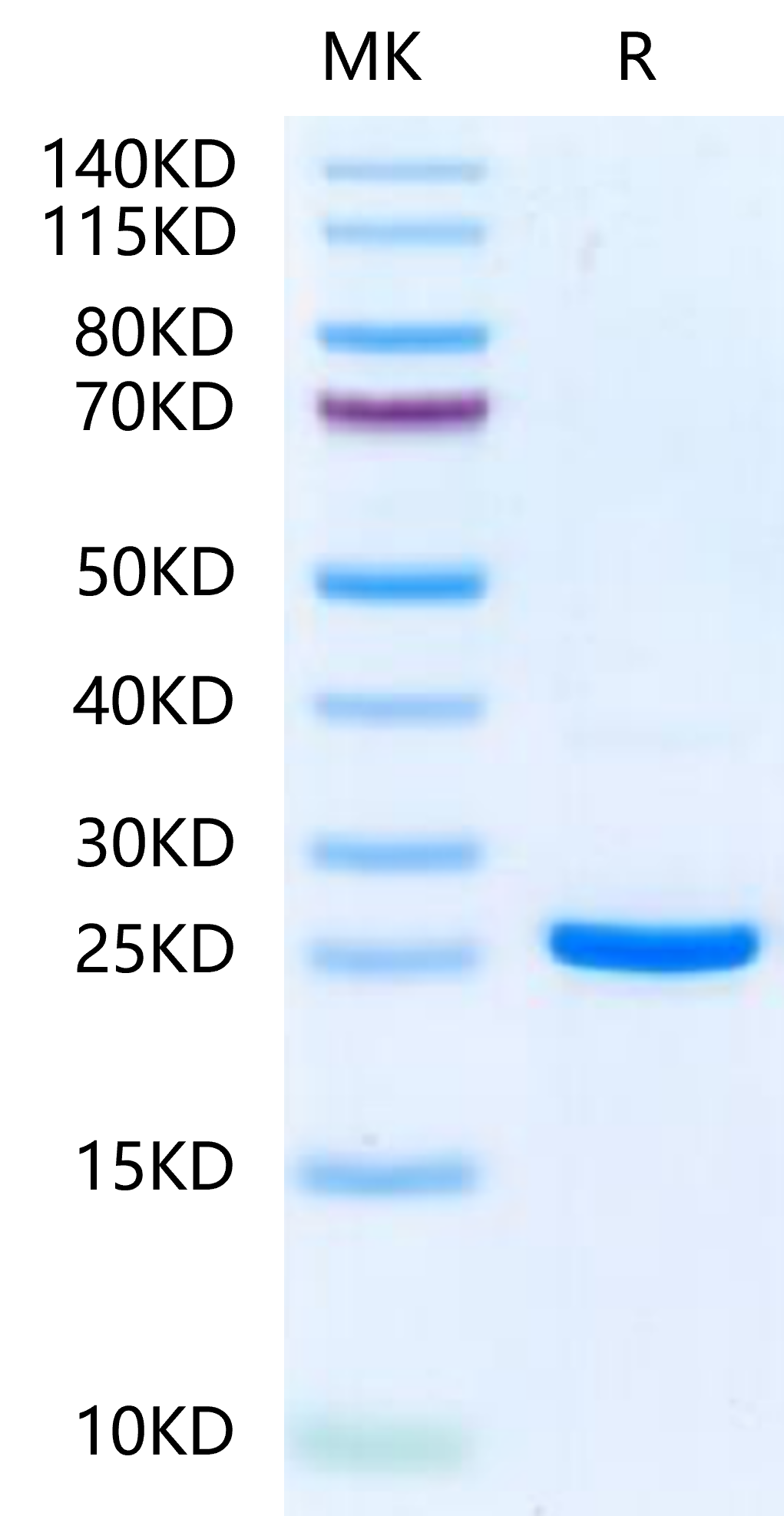 Human NRAS-Protein, Ultra Low Endotoxin (NRS-HE101-UL)