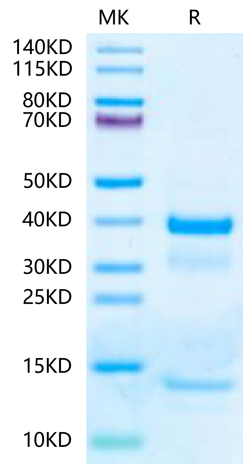 Mouse tPA-Protein (TPA-MM101)