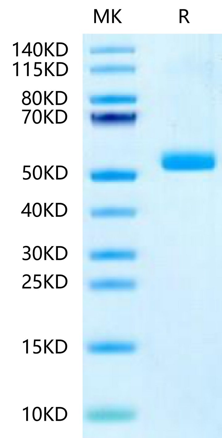 SDS-PAGE gel image showing molecular weight marker and purified recombinant protein band near 55 kDa.