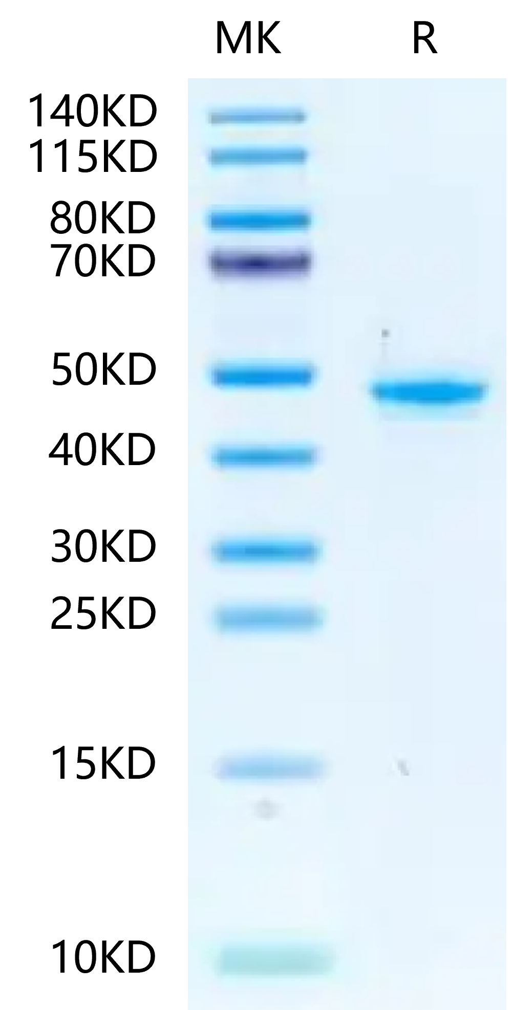 Mouse PGK1 Protein (PGK-MB101)