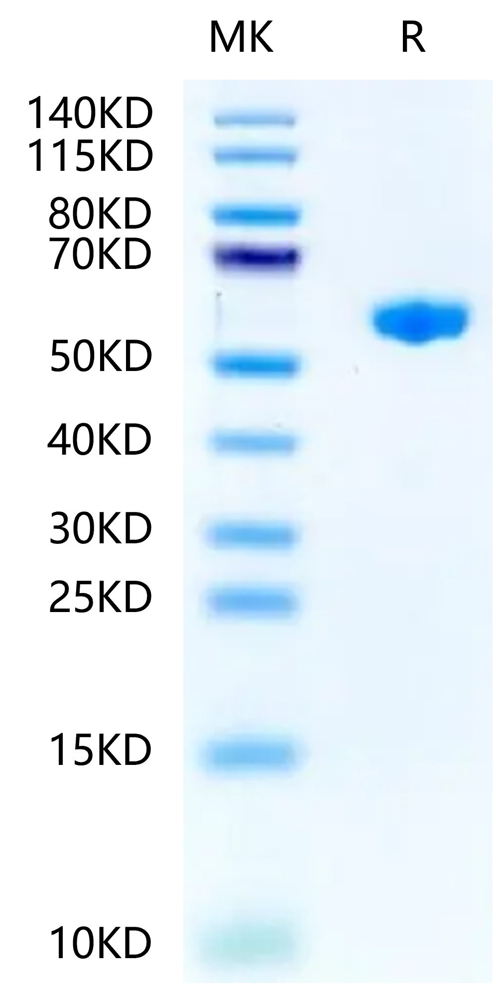 Mouse H-2K(b)&B2M&OVA (SIINFEKL) Monomer Protein (MHC-MM453)