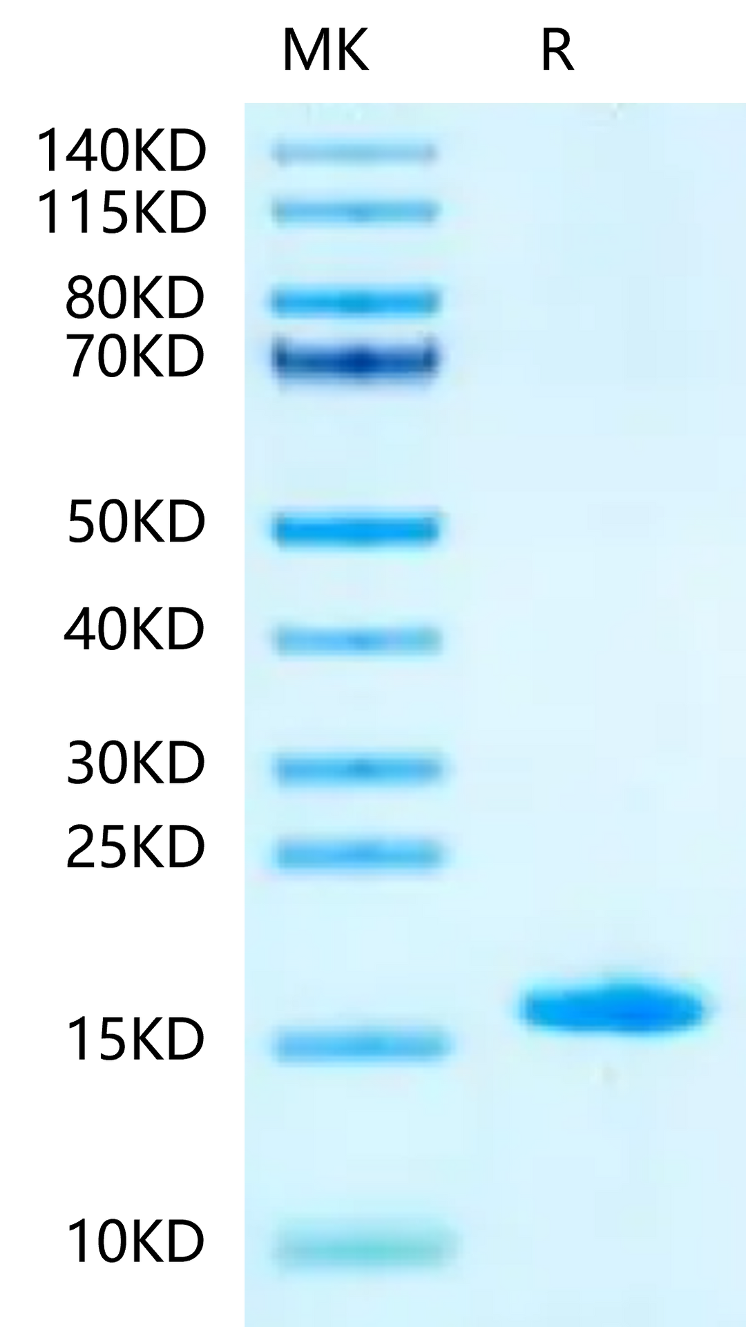 Mouse LY6A-Protein (LYA-ME006)