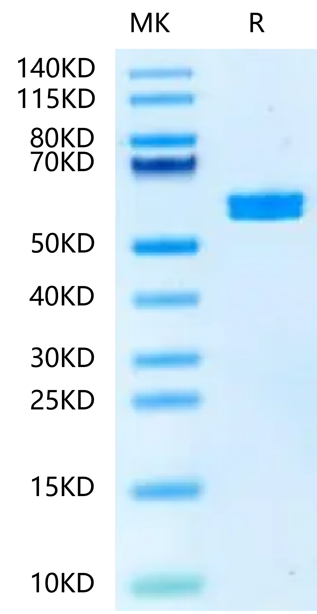 Mouse PKM2-Protein (PKM-MB102)