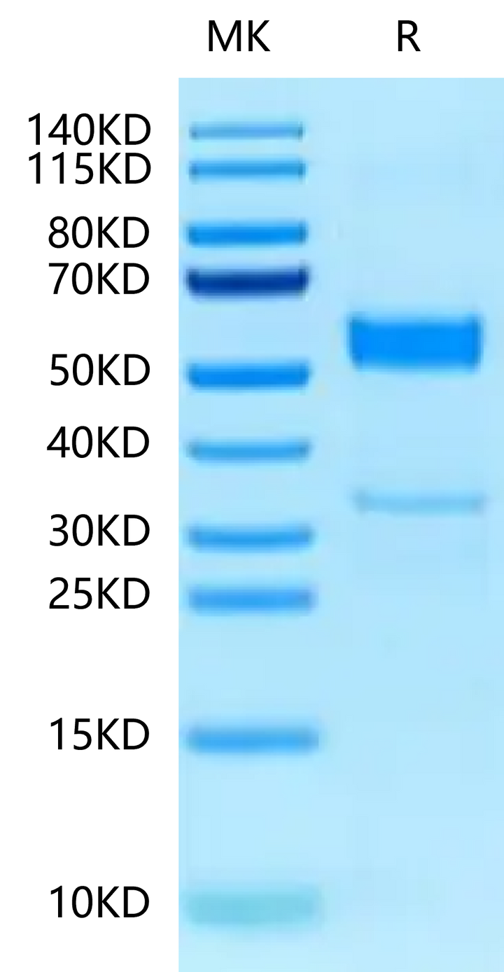 Human CLEC2B Protein (CLE-HM22B)