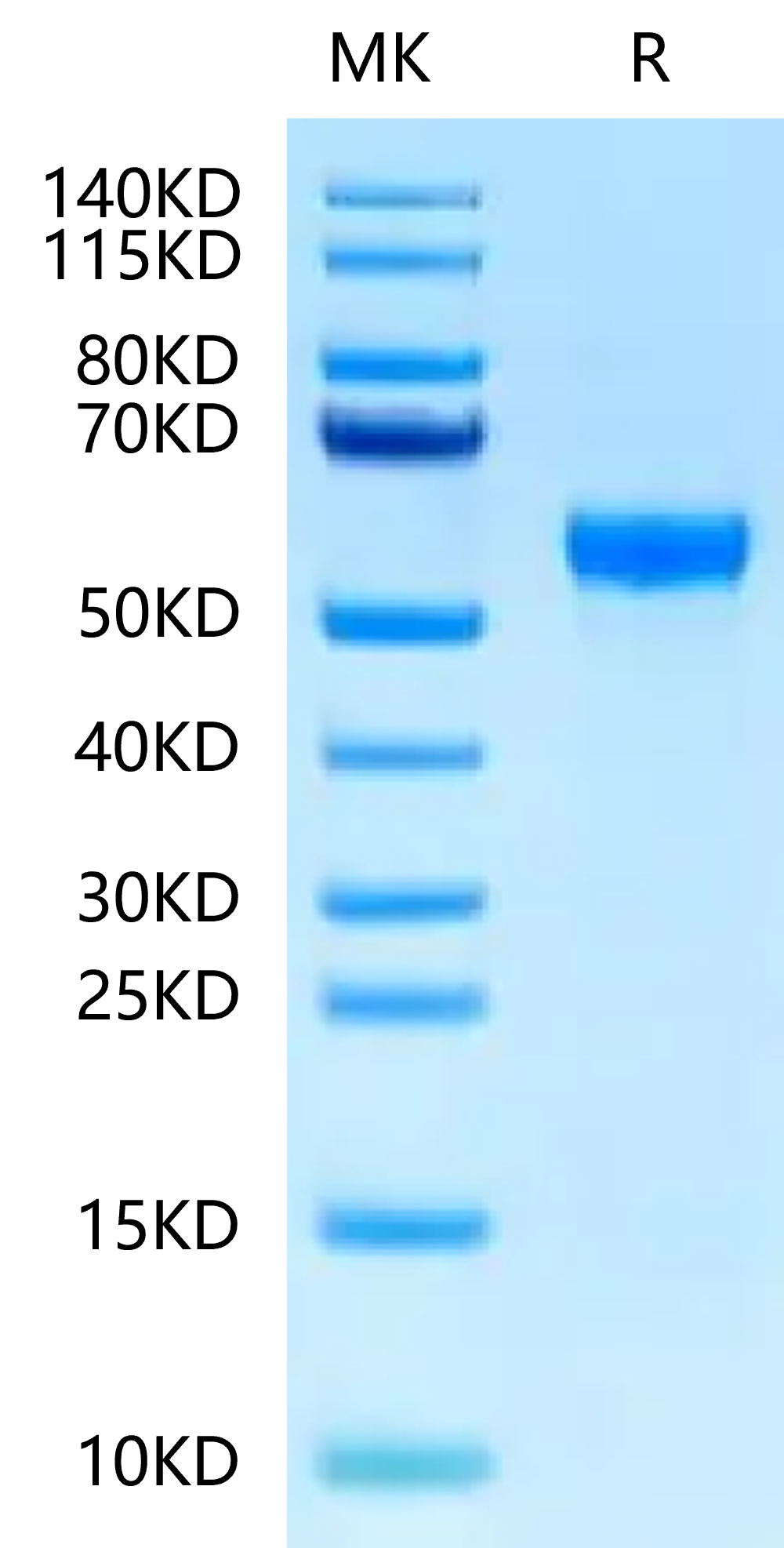 Rat Serpina3n Protein (SEP-RM101)