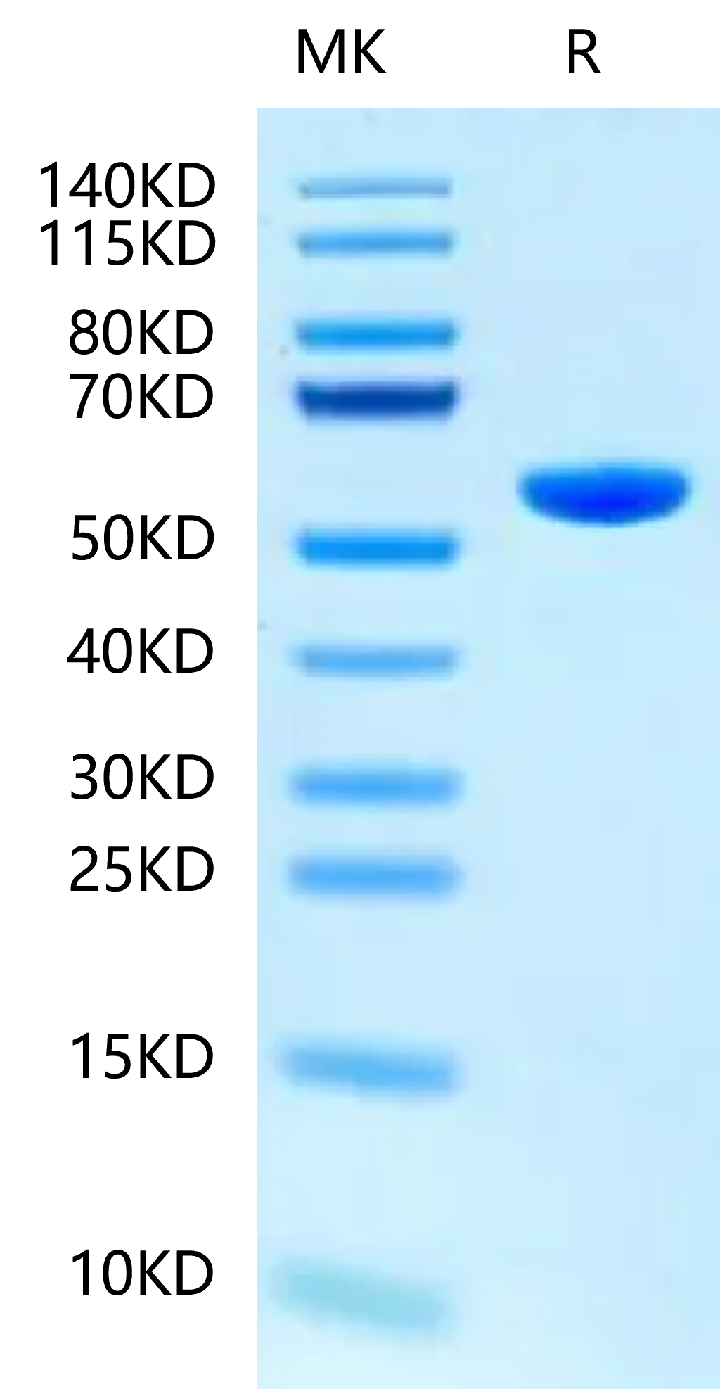 Human HLA-B*15:01&B2M&SARS-CoV-2 epitope (NQKLIANQF) Monomer Protein (MHC-HM448)