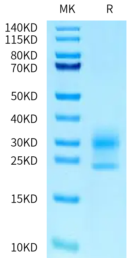 Human NPC2 Protein (NPC-HM102)