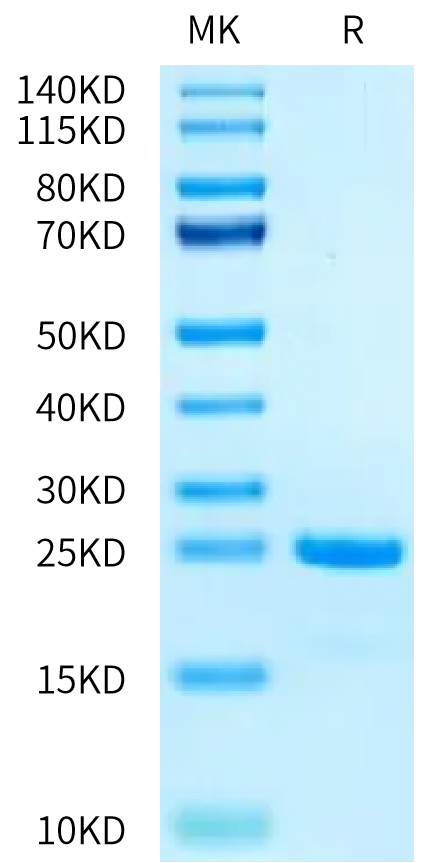 Biotinylated Human SKP1 Protein (SKP-HM401B)