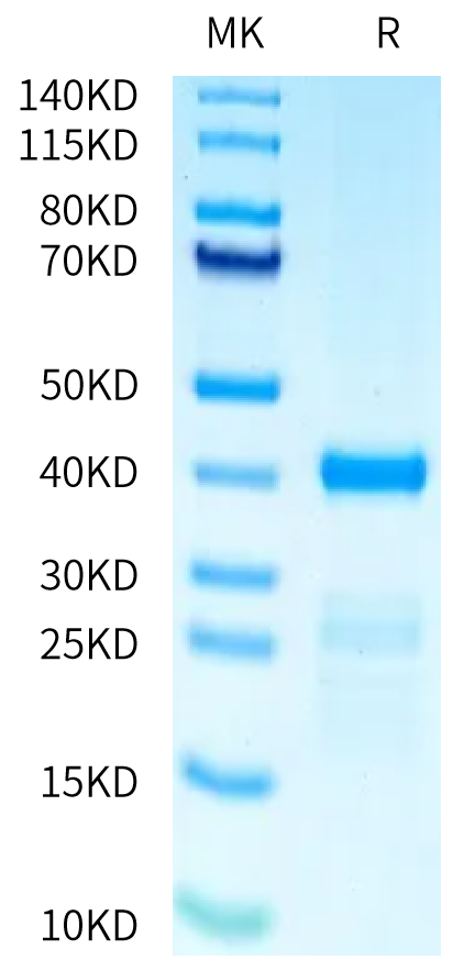 Human PRAK Protein (PRK-HB601)