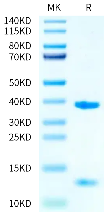 Biotinylated Human HLA-A*02:01&B2M&RAB7B (KLIIVGAIGV) Monomer Protein (MHC-HE009B)