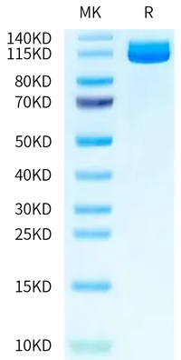 Human ENPP-3 Protein, Ultra Low Endotoxin (ENP-HM113-UL)