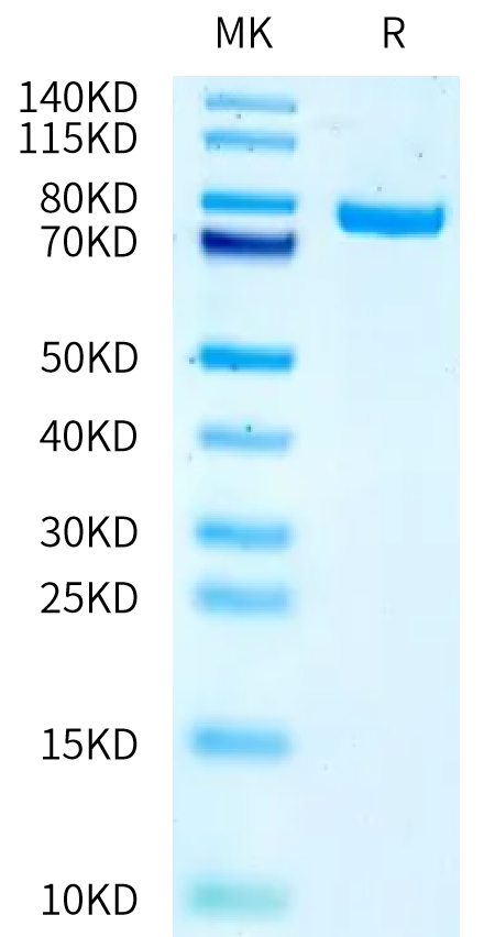 Human E-Cadherin/Cadherin 1 Protein,-Ultra Low Endotoxin (CDH-HM101-UL)