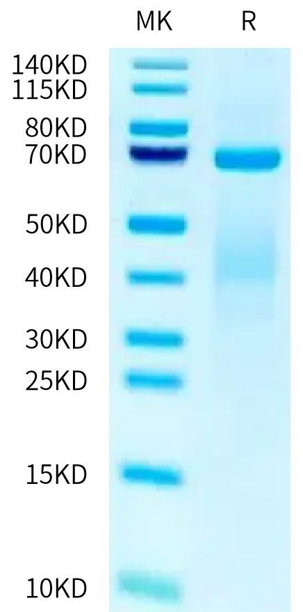 Human SMPD1 Protein (SMD-HB101)