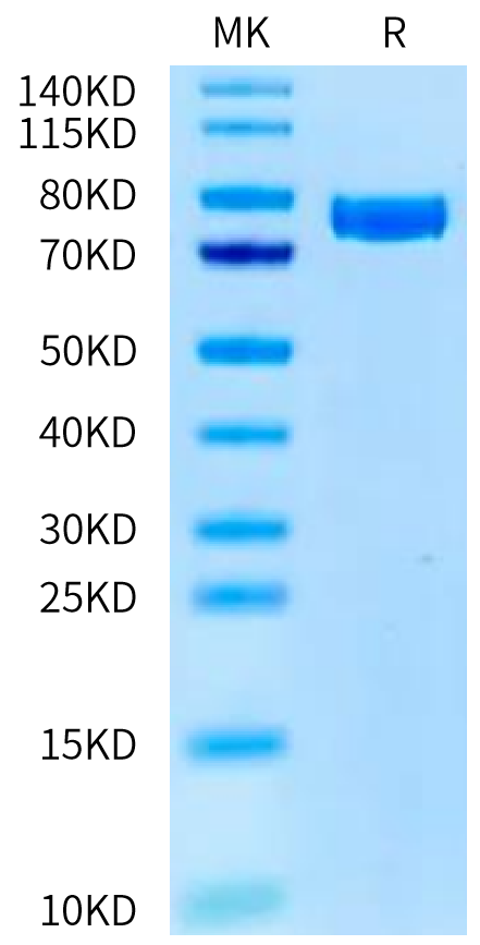 Human KLKB1 Protein (KLK-HM1B1)