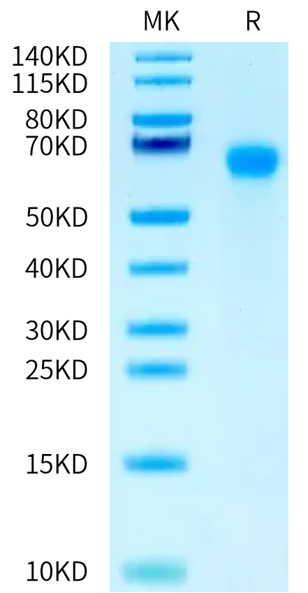 Mouse IL-6 R alpha/CD126 Protein (ILR-MM16R)