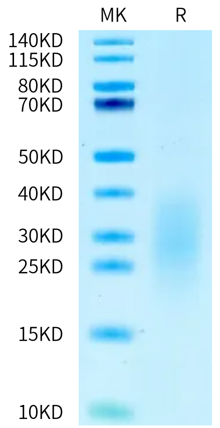 Human ALK-7/Activin RIC Protein (ALK-HM107)