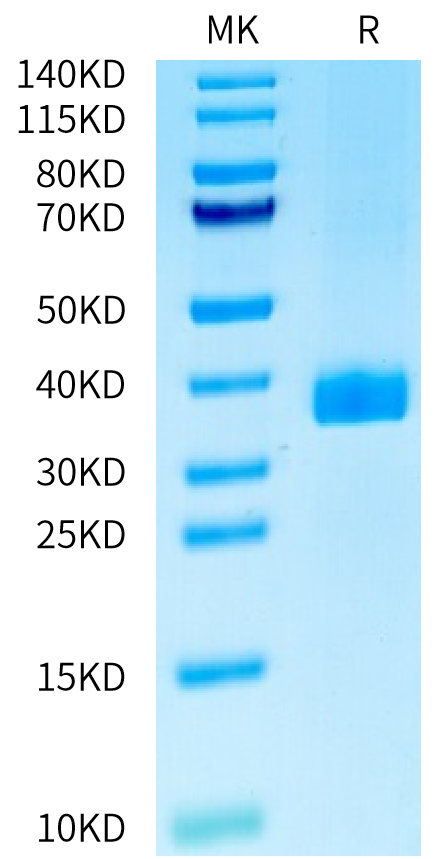 Human APOE2/Apolipoprotein E Protein (APO-HM1E2)