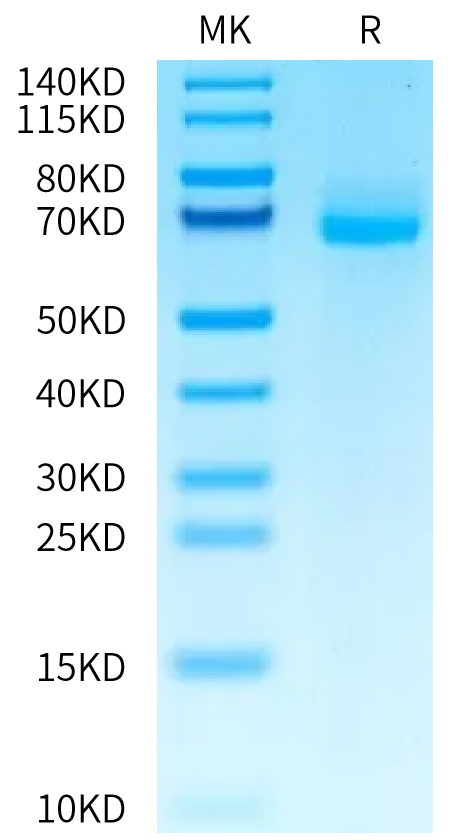 Human ALPL Protein (ALP-HM101)