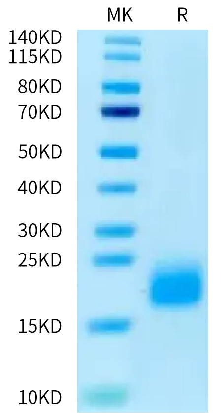 Human ACVR1B/Activin RIB Protein (ALK-HM104)