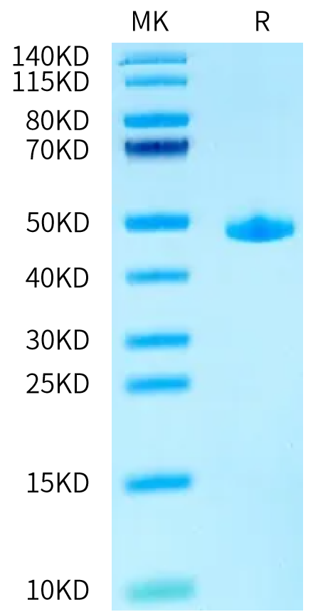 Human ACVR1/Activin RI Protein (ALK-HM202)