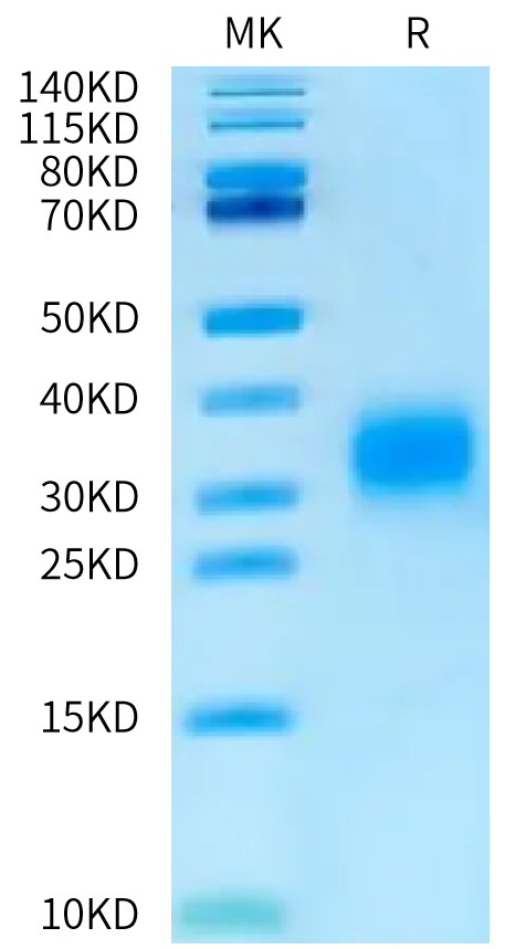 Human GIPR Protein (GIP-HM40R)