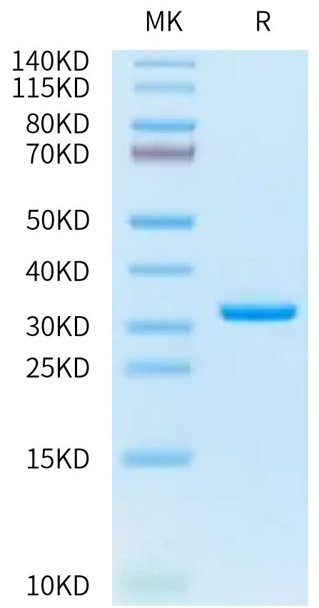 Human HMGB1 Protein (HMG-HM1B1)